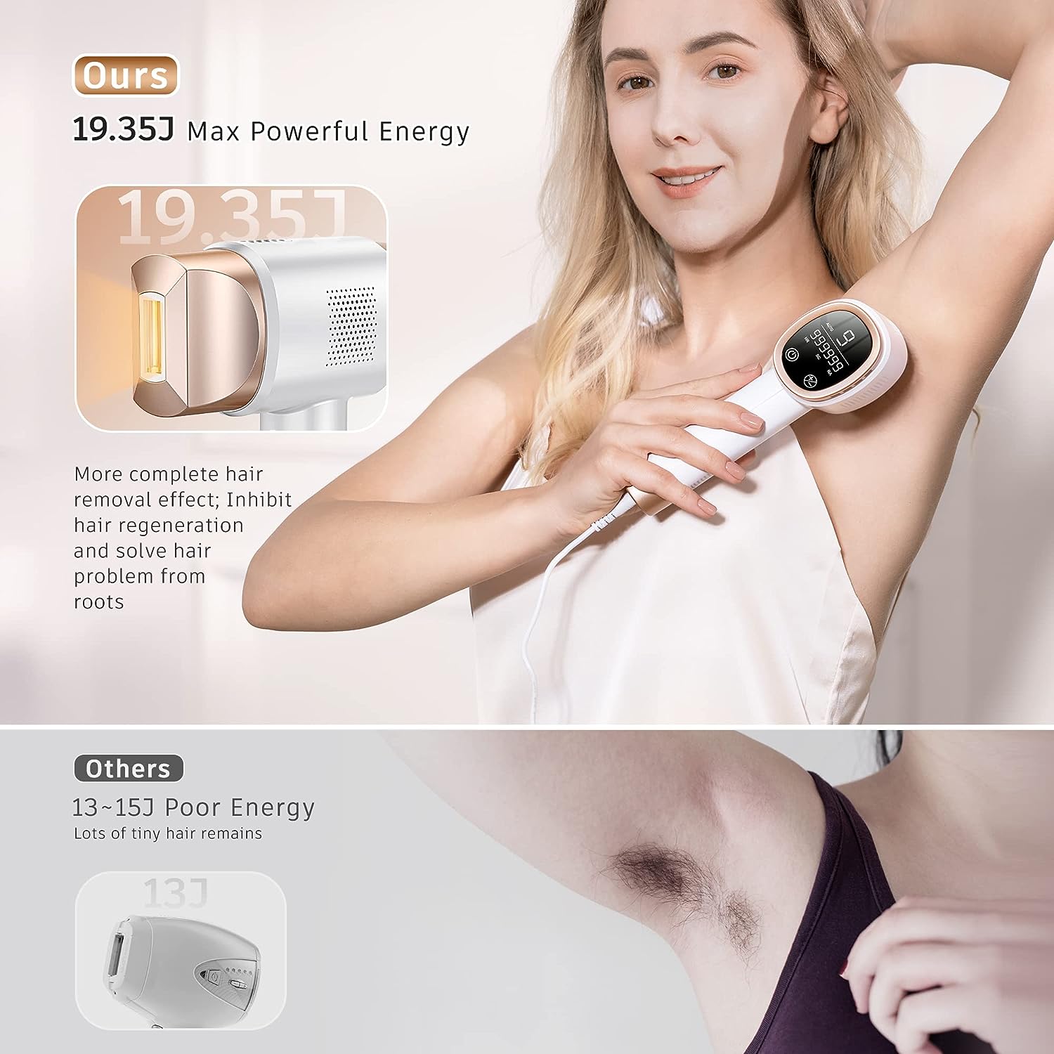 IPL underarm hair removal